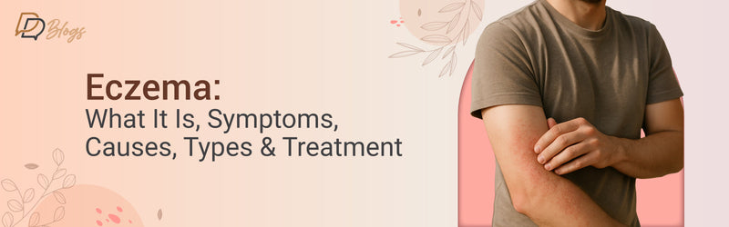 Eczema Explained: Symptoms, Causes, Types & How to Treat It