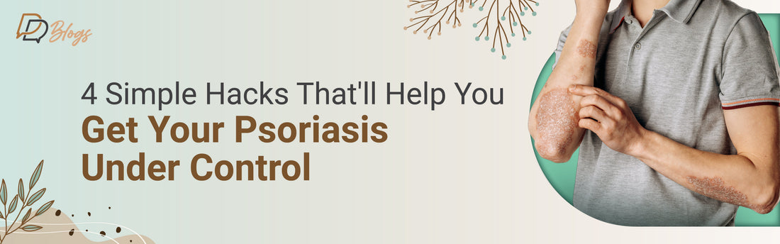 4 Simple Hacks That'll Help You Get Your Psoriasis Under Control